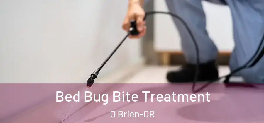 Bed Bug Bite Treatment O Brien-OR